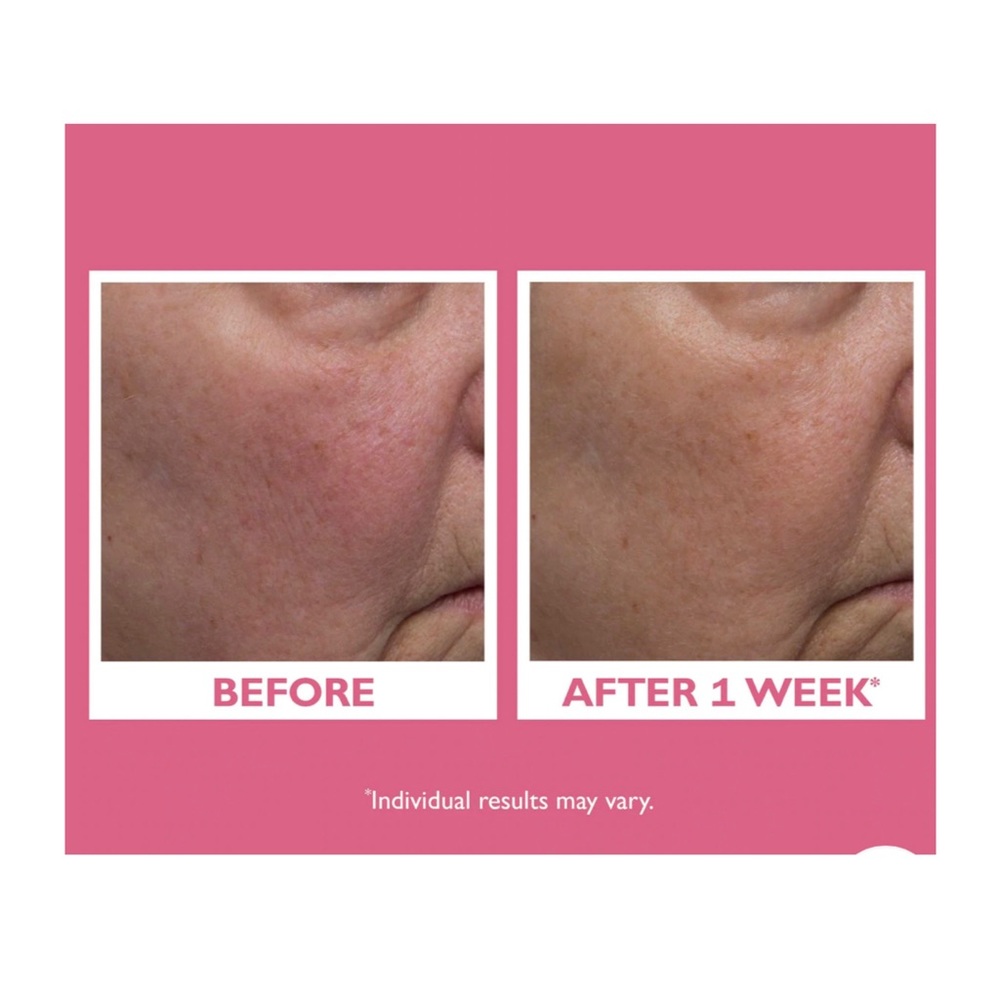 Peter Thomas Roth • Vital-E Microbiome Age Defense Cream - Picture 4 of 5